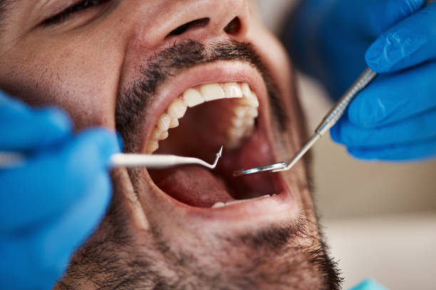 Best Emergency Treatment for Dental Infections or Abscesses in Monarch Mill, SC