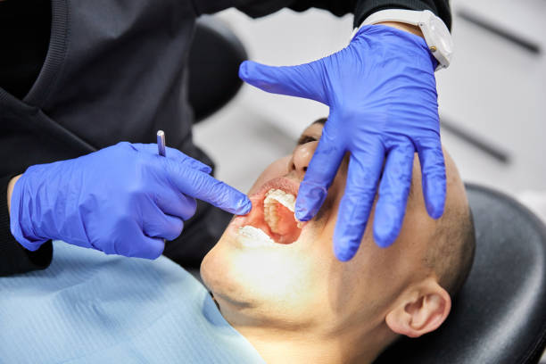 Best Emergency Gum Treatment in Monarch Mill, SC
