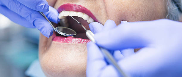Best Emergency Root Canal Treatment in Monarch Mill, SC